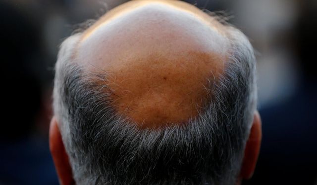 Kellik ilaçları biyoteknoloji hisselerini uçurdu